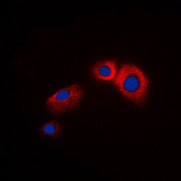 ARRB1 / Beta Arrestin 1 Antibody - Immunofluorescent analysis of Beta-arrestin-1 staining in HeLa cells. Formalin-fixed cells were permeabilized with 0.1% Triton X-100 in TBS for 5-10 minutes and blocked with 3% BSA-PBS for 30 minutes at room temperature. Cells were probed with the primary antibody in 3% BSA-PBS and incubated overnight at 4 ??C in a humidified chamber. Cells were washed with PBST and incubated with a DyLight 594-conjugated secondary antibody (red) in PBS at room temperature in the dark. DAPI was used to stain the cell nuclei (blue).