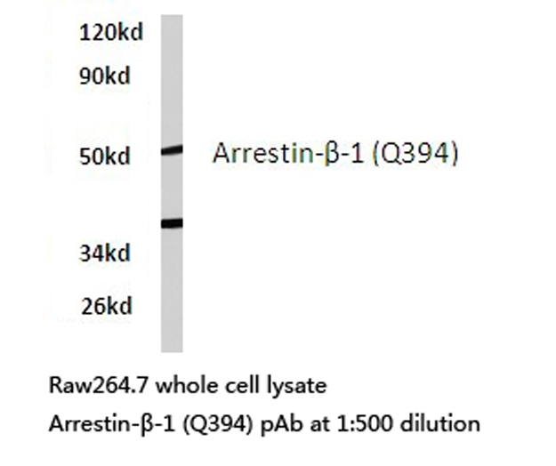 ARRB1 / Beta Arrestin 1 Antibody - Western blot of Arrestin--1 (Q394) pAb in extracts from RAW264.7 cells.