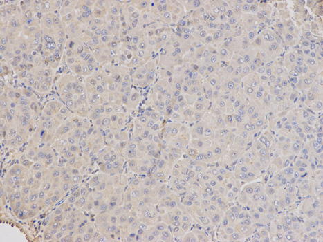 ARRB1 / Beta Arrestin 1 Antibody - Immunohistochemistry of paraffin-embedded mouse testis using ARRB1 antibody at dilution of 1:100 (200x lens).