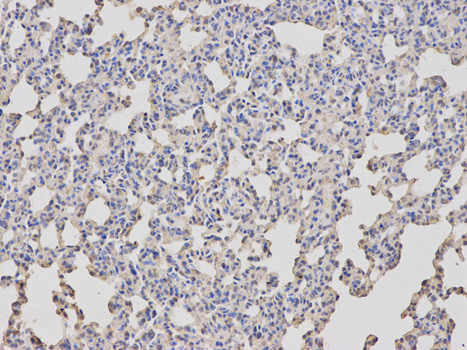 ARRB1 / Beta Arrestin 1 Antibody - Immunohistochemistry of paraffin-embedded rat lung using ARRB1 antibody at dilution of 1:100 (200x lens).