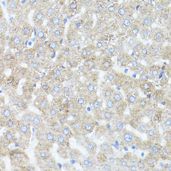 ARRB1 / Beta Arrestin 1 Antibody - Immunohistochemistry of paraffin-embedded rat liver using ARRB1 antibodyat dilution of 1:100 (40x lens).