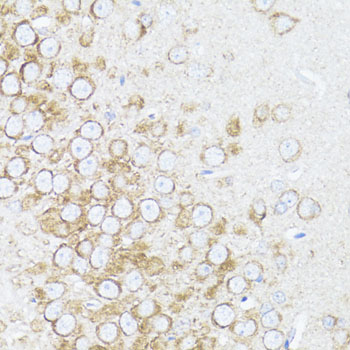 ARRB1 / Beta Arrestin 1 Antibody - Immunohistochemistry of paraffin-embedded rat brain using ARRB1 antibodyat dilution of 1:100 (40x lens).