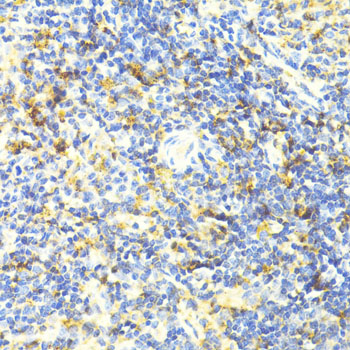 ARRB1 / Beta Arrestin 1 Antibody - Immunohistochemistry of paraffin-embedded mouse spleen using ARRB1 antibodyat dilution of 1:100 (40x lens).