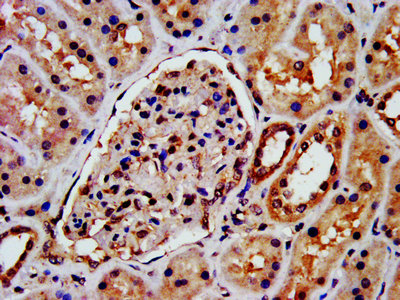 ARRB1 / Beta Arrestin 1 Antibody - IHC image of ARRB1 Antibody diluted at 1:300 and staining in paraffin-embedded human kidney tissue performed on a Leica BondTM system. After dewaxing and hydration, antigen retrieval was mediated by high pressure in a citrate buffer (pH 6.0). Section was blocked with 10% normal goat serum 30min at RT. Then primary antibody (1% BSA) was incubated at 4°C overnight. The primary is detected by a biotinylated secondary antibody and visualized using an HRP conjugated SP system.