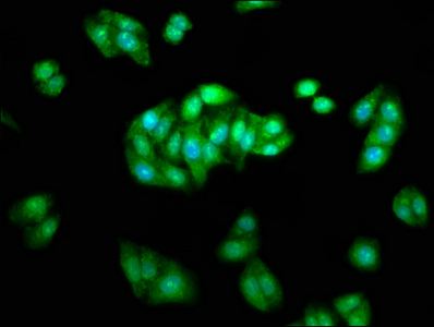ARRB1 / Beta Arrestin 1 Antibody - Immunofluorescence staining of HepG2 cells with ARRB1 Antibody at 1:233, counter-stained with DAPI. The cells were fixed in 4% formaldehyde, permeabilized using 0.2% Triton X-100 and blocked in 10% normal Goat Serum. The cells were then incubated with the antibody overnight at 4°C. The secondary antibody was Alexa Fluor 488-congugated AffiniPure Goat Anti-Rabbit IgG(H+L).