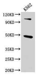 ARRB1 / Beta Arrestin 1 Antibody - Western Blot Positive WB detected in: Rat brain tissue All lanes: ARRB1 antibody at 4.6µg/ml Secondary Goat polyclonal to rabbit IgG at 1/50000 dilution Predicted band size: 48, 47 kDa Observed band size: 48 kDa