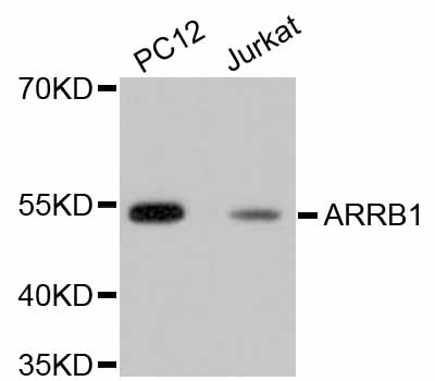 ARRB1 / Beta Arrestin 1 Antibody - Western blot analysis of extracts of various cell lines, using ARRB1 antibody. The secondary antibody used was an HRP Goat Anti-Rabbit IgG (H+L) at 1:10000 dilution. Lysates were loaded 25ug per lane and 3% nonfat dry milk in TBST was used for blocking.