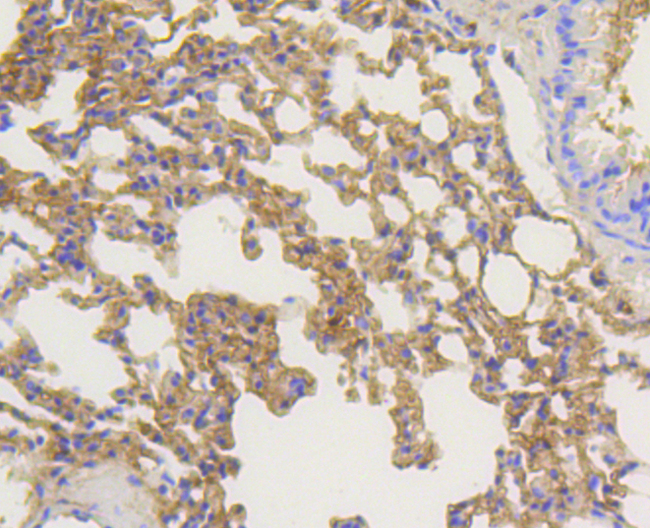 ARRB1 / Beta Arrestin 1 Antibody - Immunohistochemistry of paraffin-embedded mouse lung using ARRB1 antibodyat dilution of 1:100 (40x lens).