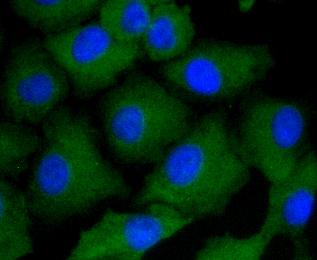 ARRB1 / Beta Arrestin 1 Antibody - Immunofluorescence analysis of A549 cells using ARRB1 antibody.