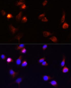 ARRB1 / Beta Arrestin 1 Antibody - Immunofluorescence analysis of A431 cells using ARRB1 antibody at dilution of 1:100 (40x lens). Blue: DAPI for nuclear staining.