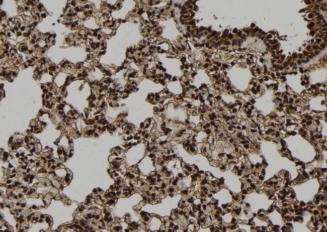 ARRB1 / Beta Arrestin 1 Antibody - 1:100 staining rat lung tissue by IHC-P. The sample was formaldehyde fixed and a heat mediated antigen retrieval step in citrate buffer was performed. The sample was then blocked and incubated with the antibody for 1.5 hours at 22°C. An HRP conjugated goat anti-rabbit antibody was used as the secondary.