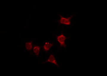 ARRB1 / Beta Arrestin 1 Antibody - Staining A549 cells by IF/ICC. The samples were fixed with PFA and permeabilized in 0.1% Triton X-100, then blocked in 10% serum for 45 min at 25°C. The primary antibody was diluted at 1:200 and incubated with the sample for 1 hour at 37°C. An Alexa Fluor 594 conjugated goat anti-rabbit IgG (H+L) Ab, diluted at 1/600, was used as the secondary antibody.