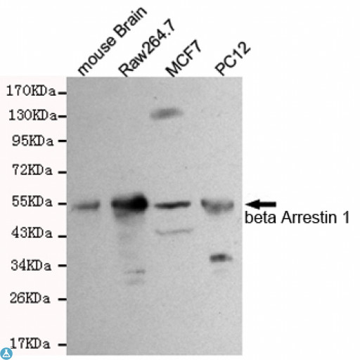ARRB1 / Beta Arrestin 1 Antibody - Western blot detection of beta Arrestin 1 in PC12, Raw264. 7, MCF7 and mouse brain cell lysates using beta Arrestin 1 mouse mAb (1:500 diluted). Predicted band size: 50KDa. Observed band size: 50KDa.