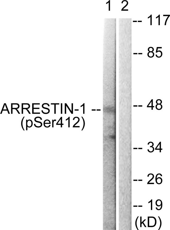ARRB1 / Beta Arrestin 1 Antibody - Western blot analysis of lysates from COS7 cells treated with Etoposide 25uM 60', using Arrestin 1 (Phospho-Ser412) Antibody. The lane on the right is blocked with the phospho peptide.