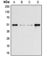 ARRB1 / Beta Arrestin 1 Antibody - Western blot analysis of Beta-arrestin-1 (pS412) expression in HeLa (A); HEK293T (B); Raw264.7 (C); rat kidney (D) whole cell lysates.