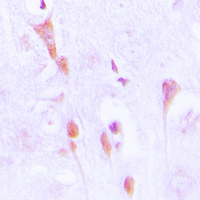 ARRB1 / Beta Arrestin 1 Antibody - Immunohistochemical analysis of Beta-arrestin-1 (pS412) staining in human brain formalin fixed paraffin embedded tissue section. The section was pre-treated using heat mediated antigen retrieval with sodium citrate buffer (pH 6.0). The section was then incubated with the antibody at room temperature and detected using an HRP conjugated compact polymer system. DAB was used as the chromogen. The section was then counterstained with hematoxylin and mounted with DPX.
