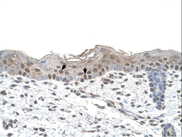 ARRB2 / Beta Arrestin 2 Antibody - ARRB2 / Beta-Arrestin 2 antibody ARRB2(arrestin, beta 2) Antibody was used in IHC to stain formalin-fixed, paraffin-embedded human skin.  This image was taken for the unconjugated form of this product. Other forms have not been tested.