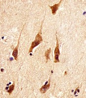 ARRB2 / Beta Arrestin 2 Antibody - Antibody staining ARRB2 in human brain tissue sections by Immunohistochemistry (IHC-P - paraformaldehyde-fixed, paraffin-embedded sections). Tissue was fixed with formaldehyde and blocked with 3% BSA for 0. 5 hour at room temperature; antigen retrieval was by heat mediation with a citrate buffer (pH 6). Samples were incubated with primary antibody (1:25) for 1 hours at 37°C. A undiluted biotinylated goat polyvalent antibody was used as the secondary antibody.