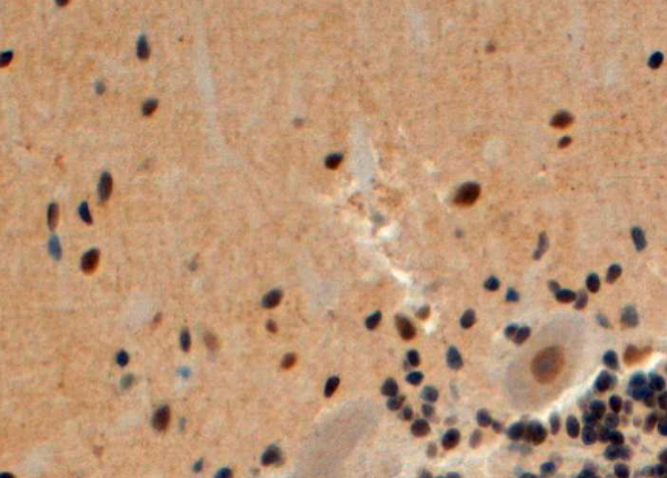 ARRB2 / Beta Arrestin 2 Antibody - Goat Anti-Arrestin beta 2 Antibody (4µg/ml) staining of paraffin embedded Human Cerebellum. Steamed antigen retrieval with citrate buffer pH 6, HRP-staining. This data is from a previous batch, not on sale.