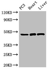 ARRB2 / Beta Arrestin 2 Antibody - Positive WB detected in:PC3 whole cell lysate,Rat heart tissue,Rat liver tissue;All lanes:ARRB2 antibody at 3.5?g/ml;Secondary;Goat polyclonal to rabbit IgG at 1/50000 dilution;Predicted band size: 47,48,46,49,45 KDa;Observed band size: 47 KDa;