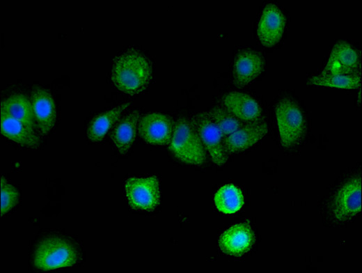 ARRB2 / Beta Arrestin 2 Antibody - Immunofluorescent analysis of HepG2 cells using ARRB2 Antibody at a dilution of 1:100 and Alexa Fluor 488-congugated AffiniPure Goat Anti-Rabbit IgG(H+L)
