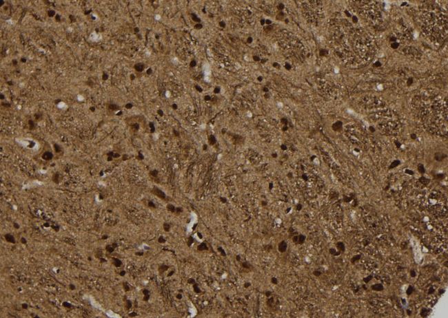 ARRB2 / Beta Arrestin 2 Antibody - 1:100 staining rat brain tissue by IHC-P. The sample was formaldehyde fixed and a heat mediated antigen retrieval step in citrate buffer was performed. The sample was then blocked and incubated with the antibody for 1.5 hours at 22°C. An HRP conjugated goat anti-rabbit antibody was used as the secondary.