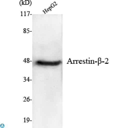 ARRB2 / Beta Arrestin 2 Antibody - Immunofluorescence (IF) analysis of HeLa cells using Arrestin-beta-2 Monoclonal Antibody.