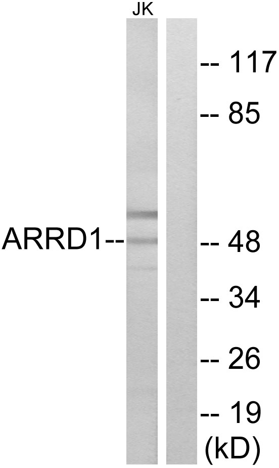 ARRDC1 Antibody - Western blot analysis of lysates from Jurkat cells, using ARRD1 Antibody. The lane on the right is blocked with the synthesized peptide.