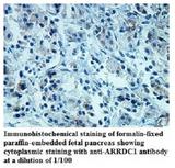 ARRDC1 Antibody - Immunohistochemistry of ARRDC1 antibody