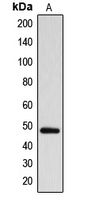 ARRDC1 Antibody - Western blot analysis of ARRDC1 expression in MDAMB231 (A) whole cell lysates.