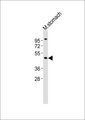 ARRDC1 Antibody - Anti-ARRDC1 Antibody at 1:1000 dilution + mouse stomach lysates Lysates/proteins at 20 ug per lane. Secondary Goat Anti-Rabbit IgG, (H+L),Peroxidase conjugated at 1/10000 dilution Predicted band size : 46 kDa Blocking/Dilution buffer: 5% NFDM/TBST.