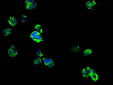 ARRDC1 Antibody - Immunofluorescence staining of MCF-7 cells diluted at 1:133, counter-stained with DAPI. The cells were fixed in 4% formaldehyde, permeabilized using 0.2% Triton X-100 and blocked in 10% normal Goat Serum. The cells were then incubated with the antibody overnight at 4°C.The Secondary antibody was Alexa Fluor 488-congugated AffiniPure Goat Anti-Rabbit IgG (H+L).