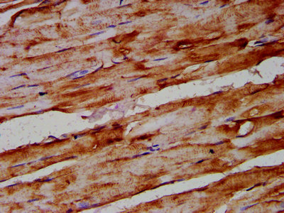 ARRDC1 Antibody - Immunohistochemistry Dilution at 1:400 and staining in paraffin-embedded human skeletal muscle tissue performed on a Leica BondTM system. After dewaxing and hydration, antigen retrieval was mediated by high pressure in a citrate buffer (pH 6.0). Section was blocked with 10% normal Goat serum 30min at RT. Then primary antibody (1% BSA) was incubated at 4°C overnight. The primary is detected by a biotinylated Secondary antibody and visualized using an HRP conjugated SP system.