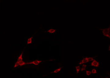 ARRDC1 Antibody - Staining HeLa cells by IF/ICC. The samples were fixed with PFA and permeabilized in 0.1% Triton X-100, then blocked in 10% serum for 45 min at 25°C. The primary antibody was diluted at 1:200 and incubated with the sample for 1 hour at 37°C. An Alexa Fluor 594 conjugated goat anti-rabbit IgG (H+L) Ab, diluted at 1/600, was used as the secondary antibody.