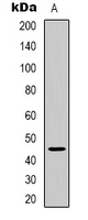 ARRDC2 Antibody - Western blot analysis of ARRDC2 expression in HEK293T (A) whole cell lysates.