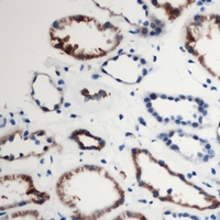ARRDC2 Antibody - Immunohistochemical analysis of ARRDC2 staining in human kidney formalin fixed paraffin embedded tissue section. The section was pre-treated using heat mediated antigen retrieval with sodium citrate buffer (pH 6.0). The section was then incubated with the antibody at room temperature and detected with HRP and DAB as chromogen. The section was then counterstained with hematoxylin and mounted with DPX.