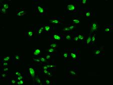 ARRDC2 Antibody - Immunofluorescence staining of ARRDC2 in PC3 cells. Cells were fixed with 4% PFA, permeabilzed with 0.1% Triton X-100 in PBS, blocked with 10% serum, and incubated with rabbit anti-Human ARRDC2 polyclonal antibody (dilution ratio 1:200) at 4°C overnight. Then cells were stained with the Alexa Fluor 488-conjugated Goat Anti-rabbit IgG secondary antibody (green). Positive staining was localized to Nucleus and Cytoplasm.