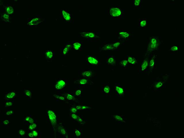 ARRDC2 Antibody - Immunofluorescence staining of ARRDC2 in PC3 cells. Cells were fixed with 4% PFA, permeabilzed with 0.1% Triton X-100 in PBS, blocked with 10% serum, and incubated with rabbit anti-Human ARRDC2 polyclonal antibody (dilution ratio 1:200) at 4°C overnight. Then cells were stained with the Alexa Fluor 488-conjugated Goat Anti-rabbit IgG secondary antibody (green). Positive staining was localized to Nucleus and Cytoplasm.