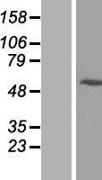 ARRDC2 Protein - Western validation with an anti-DDK antibody * L: Control HEK293 lysate R: Over-expression lysate