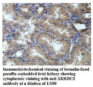 ARRDC3 Antibody - Immunohistochemistry of ARRDC3 antibody