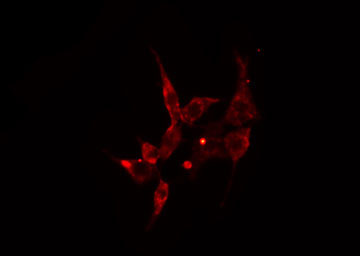 ARRDC3 Antibody - Staining HeLa cells by IF/ICC. The samples were fixed with PFA and permeabilized in 0.1% Triton X-100, then blocked in 10% serum for 45 min at 25°C. The primary antibody was diluted at 1:200 and incubated with the sample for 1 hour at 37°C. An Alexa Fluor 594 conjugated goat anti-rabbit IgG (H+L) antibody, diluted at 1/600, was used as secondary antibody.