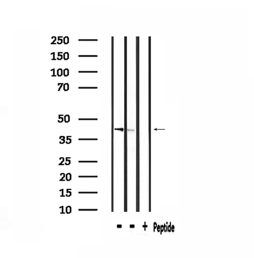 ARRDC3 Antibody - Western blot analysis of extracts of 293 cells and mouse brain tissue using ARRDC3 antibody.