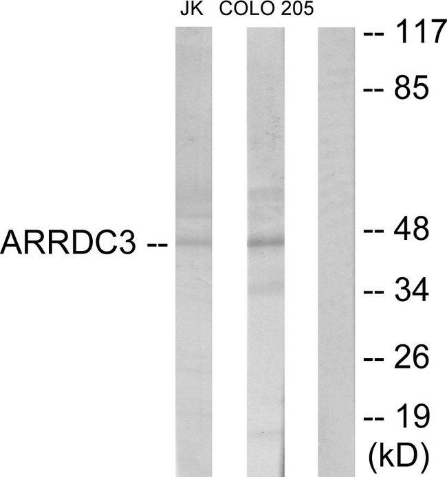 ARRDC3 Antibody - Western blot analysis of extracts from Jurkat cells and COLO205 cells, using ARRDC3 antibody.