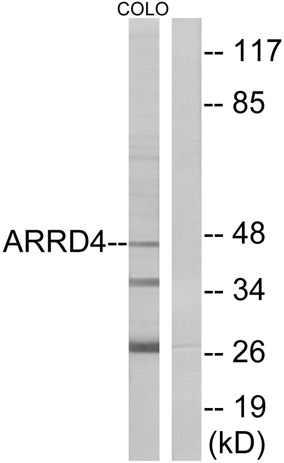 ARRDC4 Antibody - Western blot analysis of lysates from COLO cells, using ARRD4 Antibody. The lane on the right is blocked with the synthesized peptide.