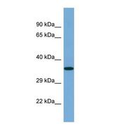 ARRDC4 Antibody - Western blot of Human THP-1. ARRDC4 antibody dilution 1.0 ug/ml.  This image was taken for the unconjugated form of this product. Other forms have not been tested.
