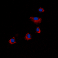 ARRDC4 Antibody - Immunofluorescent analysis of ARRDC4 staining in COLO205 cells. Formalin-fixed cells were permeabilized with 0.1% Triton X-100 in TBS for 5-10 minutes and blocked with 3% BSA-PBS for 30 minutes at room temperature. Cells were probed with the primary antibody in 3% BSA-PBS and incubated overnight at 4 C in a humidified chamber. Cells were washed with PBST and incubated with a DyLight 594-conjugated secondary antibody (red) in PBS at room temperature in the dark. DAPI was used to stain the cell nuclei (blue).