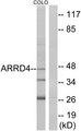 ARRDC4 Antibody - Western blot analysis of extracts from COLO cells, using ARRD4 antibody.