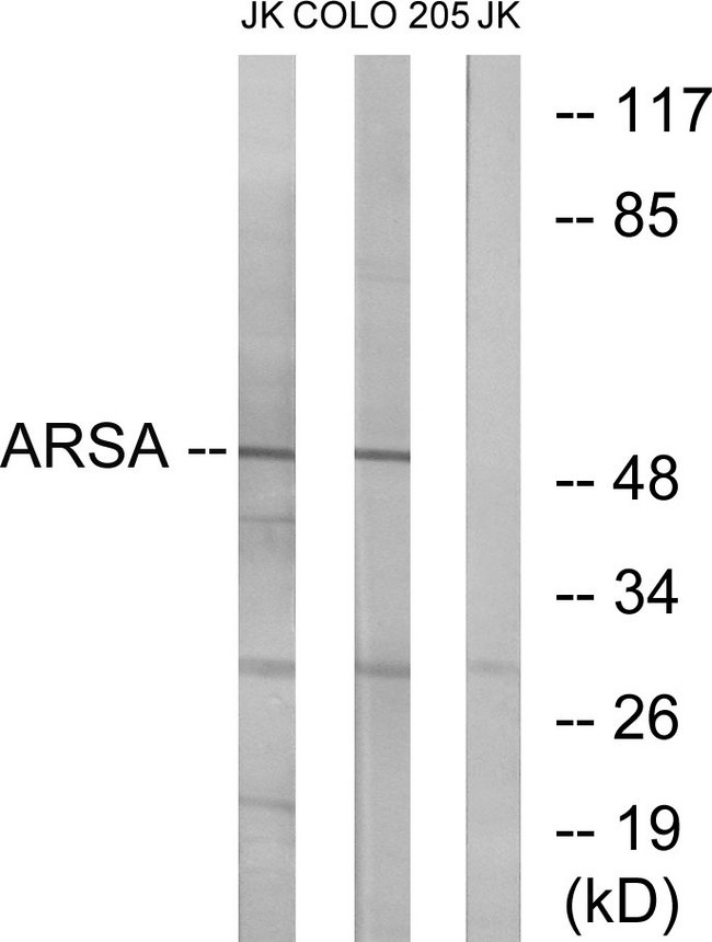 ARSA / Arylsulfatase A Antibody - Western blot analysis of lysates from Jurkat and COLO cells, using ARSA Antibody. The lane on the right is blocked with the synthesized peptide.