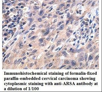ARSA / Arylsulfatase A Antibody