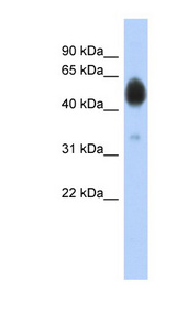ARSA / Arylsulfatase A Antibody - ARSA antibody Western blot of COLO205 cell lysate. This image was taken for the unconjugated form of this product. Other forms have not been tested.